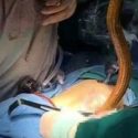 Çin'de, karın ağrısı şikayetiyle hastaneye kaldırılan bir adamın içinden yılan balığı çıktı.
