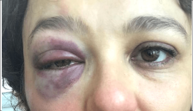Kadıköy'de, "Senin havan kime" deyip restorandaki kadını yumruklayan saldırgan