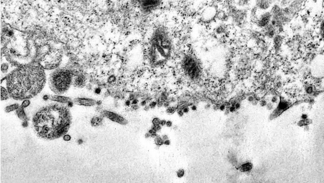 Mikroskobik bir çalışmada Covid-19'un hücreyi enfekte etmeye çalıştığı an görüntülendi.