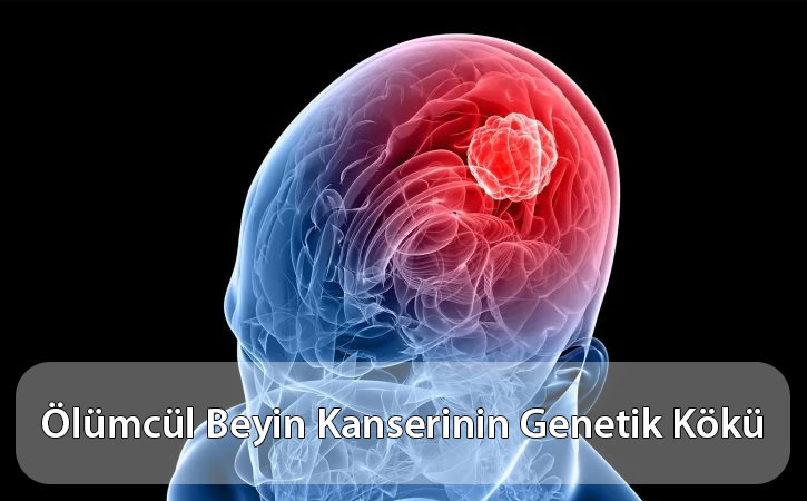 olumculbeyinkanseri