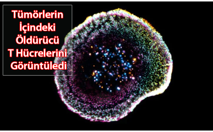 tumorlerinicindekiThucresi